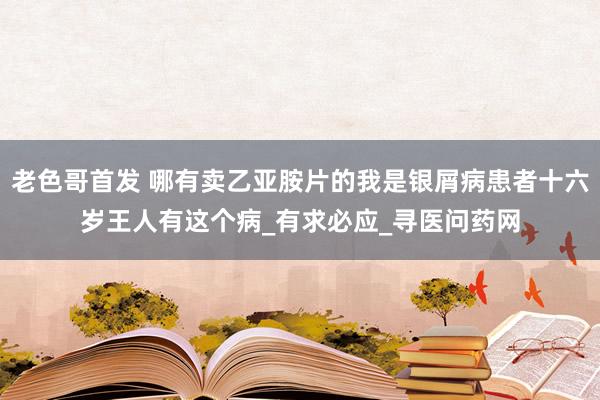 老色哥首发 哪有卖乙亚胺片的我是银屑病患者十六岁王人有这个病_有求必应_寻医问药网